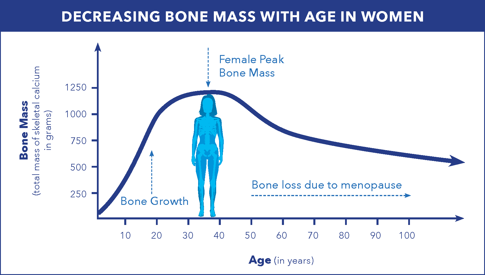 Graphique montrant la diminution de la masse osseuse chez les femmes